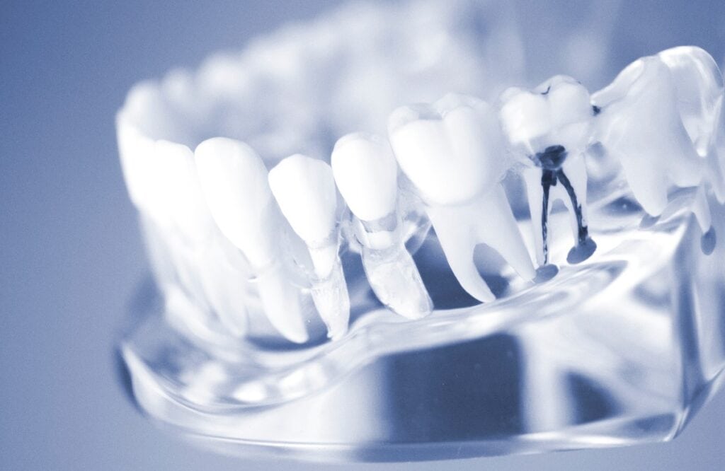 Dental teeth mouth model